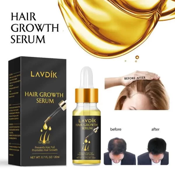 LAVDIK Ginger Fast Hair Growth Serum Essential Oil Anti Preventing Hair Lose Liquid Damaged Hair Repair Growing Dropship TSLM1 - Image 3